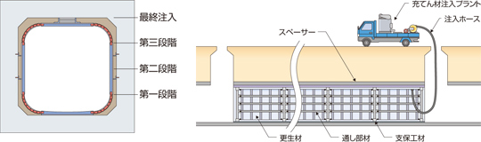 充てん材の注入